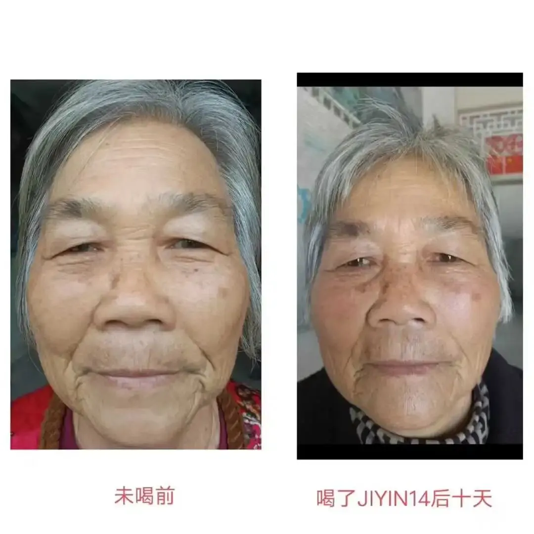 基因十四最新反馈!使用者感受最感人!市场对接15577338932了解