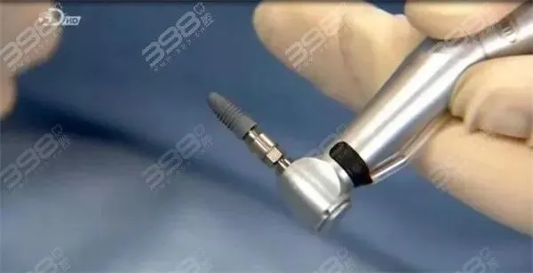 韩国爱臻植体真能用20年?是营销还是实力?看爱臻植体优缺点就知道