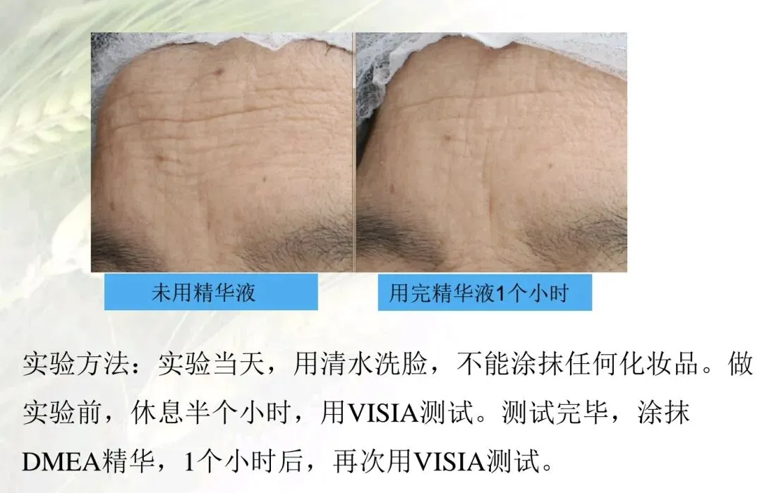 62%抗衰市场成刚需:主流成分对比,这款务实原料精准适配40+熟龄纹路人群,不失活!