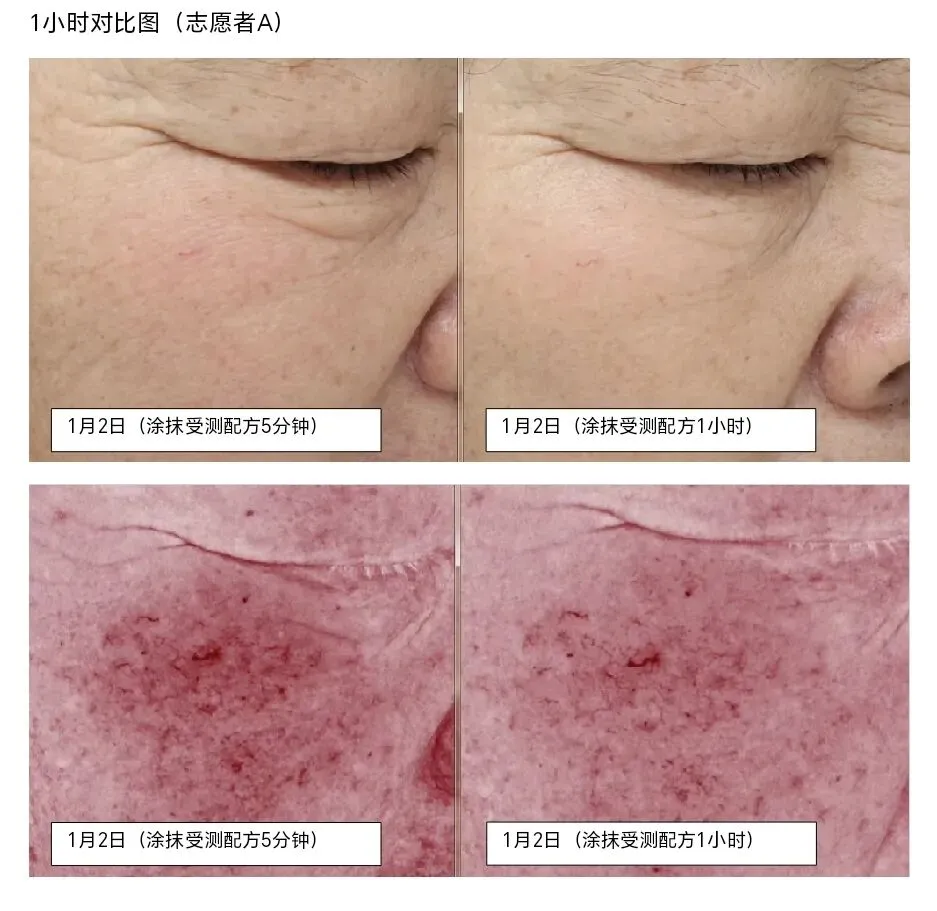 62%抗衰市场成刚需:主流成分对比,这款务实原料精准适配40+熟龄纹路人群,不失活!