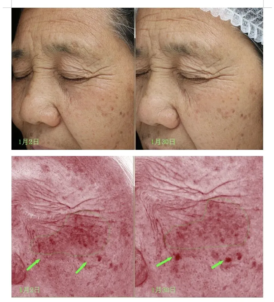 62%抗衰市场成刚需:主流成分对比,这款务实原料精准适配40+熟龄纹路人群,不失活!