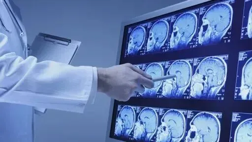 AI对就业市场的影响