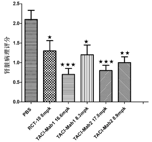 恒瑞入局,国内系统性红斑狼疮市场及在研现状