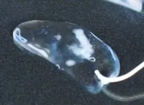 从数据看趋势:全球栓塞明胶泡沫市场持续升温,2031年规模超4.3亿