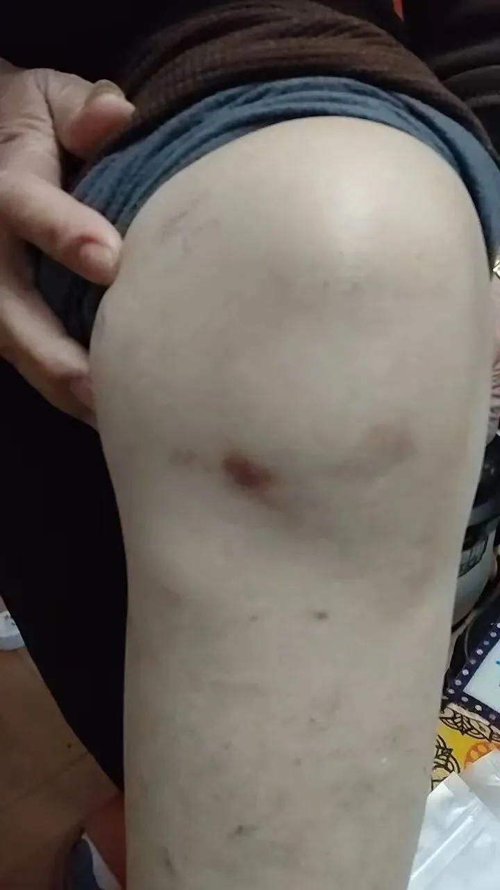 透骨膏疼痛市场各种反馈