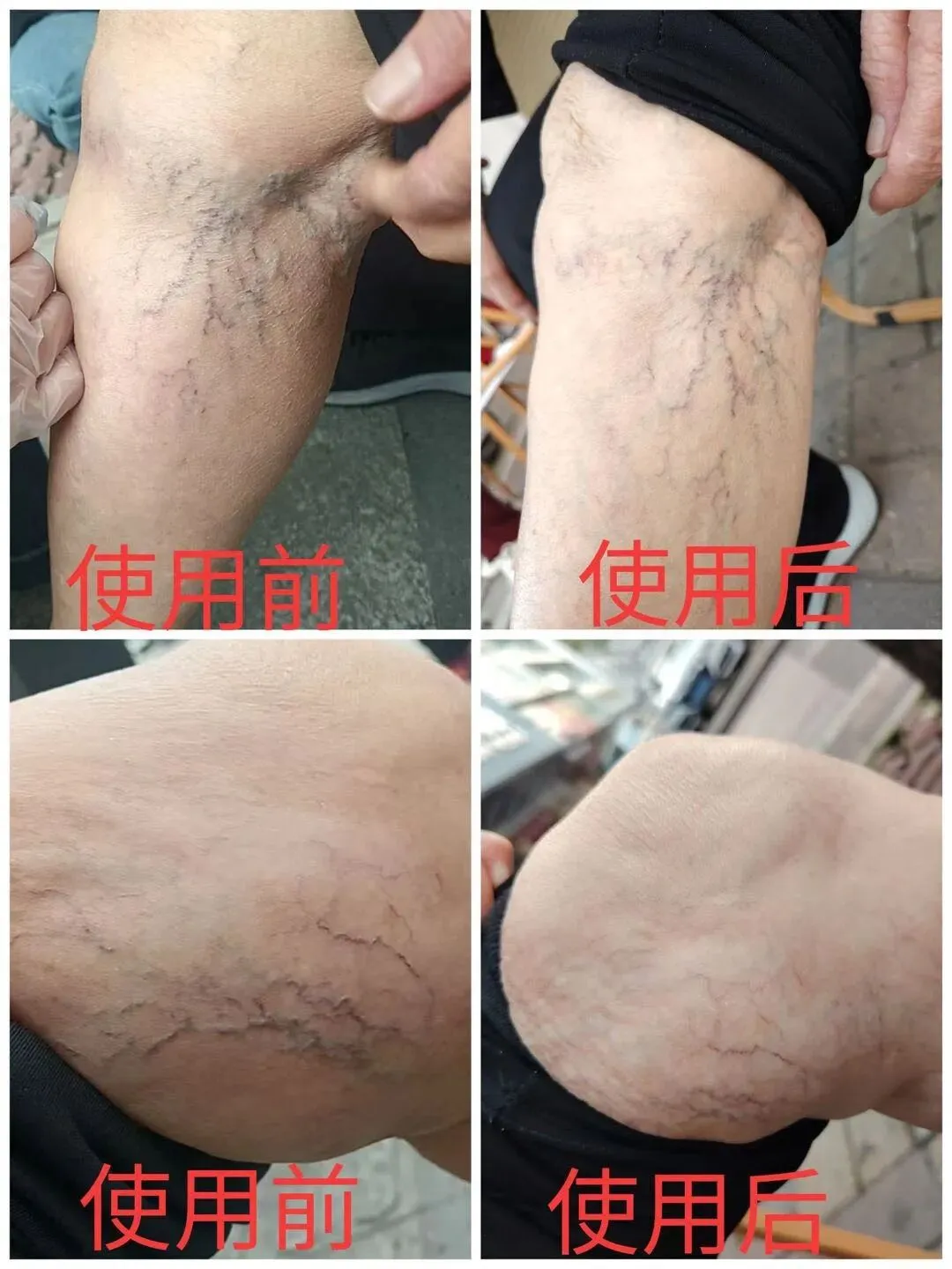 透骨膏疼痛市场各种反馈