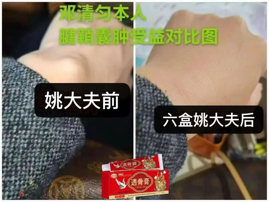 透骨膏疼痛市场各种反馈