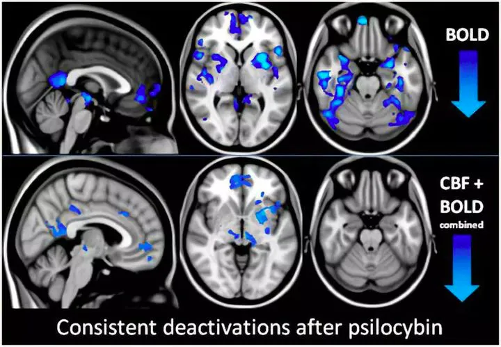 为了千亿市场,这些药企正把新型毒品塞进医生处方