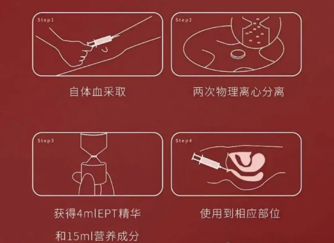 注射私处的「高潮针」,一场瞄准女性的营销骗局