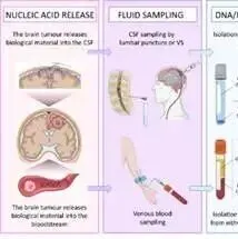 全球超免疫球蛋白市场预计2033年突破40亿美元,SCIG疗法与高端国产化驱动行业升级