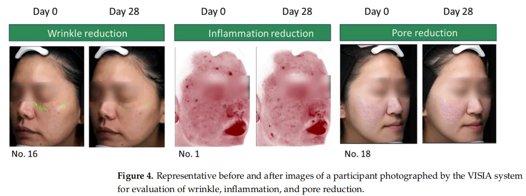 植物外泌体是护肤黑科技还是营销故事?——28天临床试验首次证实积雪草EVs精华液的多重皮肤改善效果