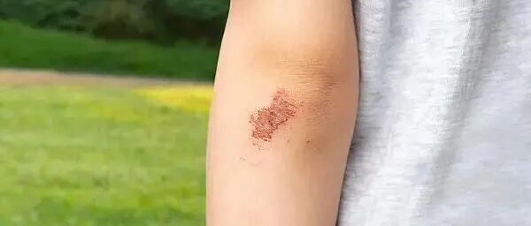 湖北人造大米流入市场?警方辟谣