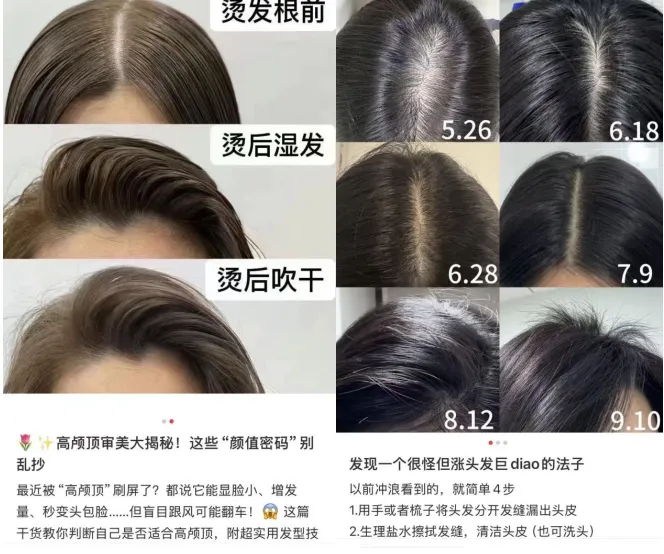 关店、砍营销、提人效:植发第一股如何“省”出7000万利润?