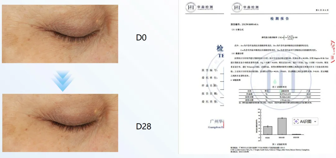 PDRN市场持续走红!YK双菌PDRN荣获中国发明专利!