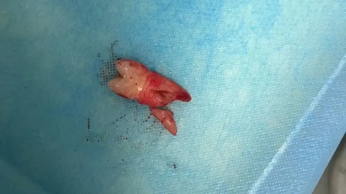 甘州区北街市场监管所开展口腔诊所专项检查