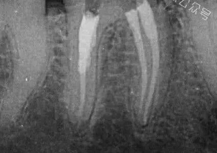 甘州区北街市场监管所开展口腔诊所专项检查