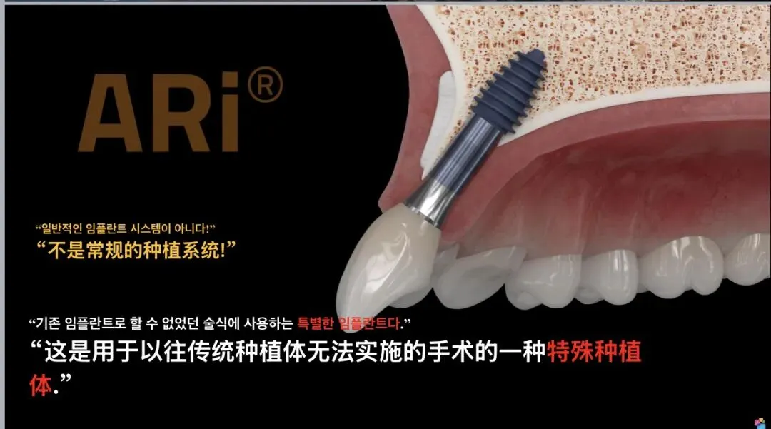 牙科诊所获客:患者离店即自动转介绍的运营妙招!