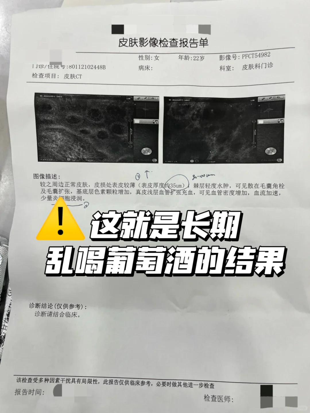 这就是长期喝葡萄酒的下场