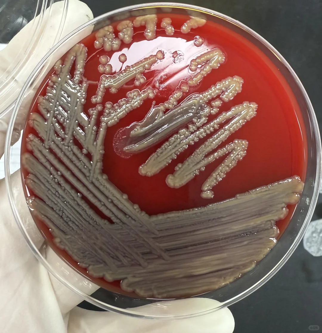微生物检验进修日志0514报告