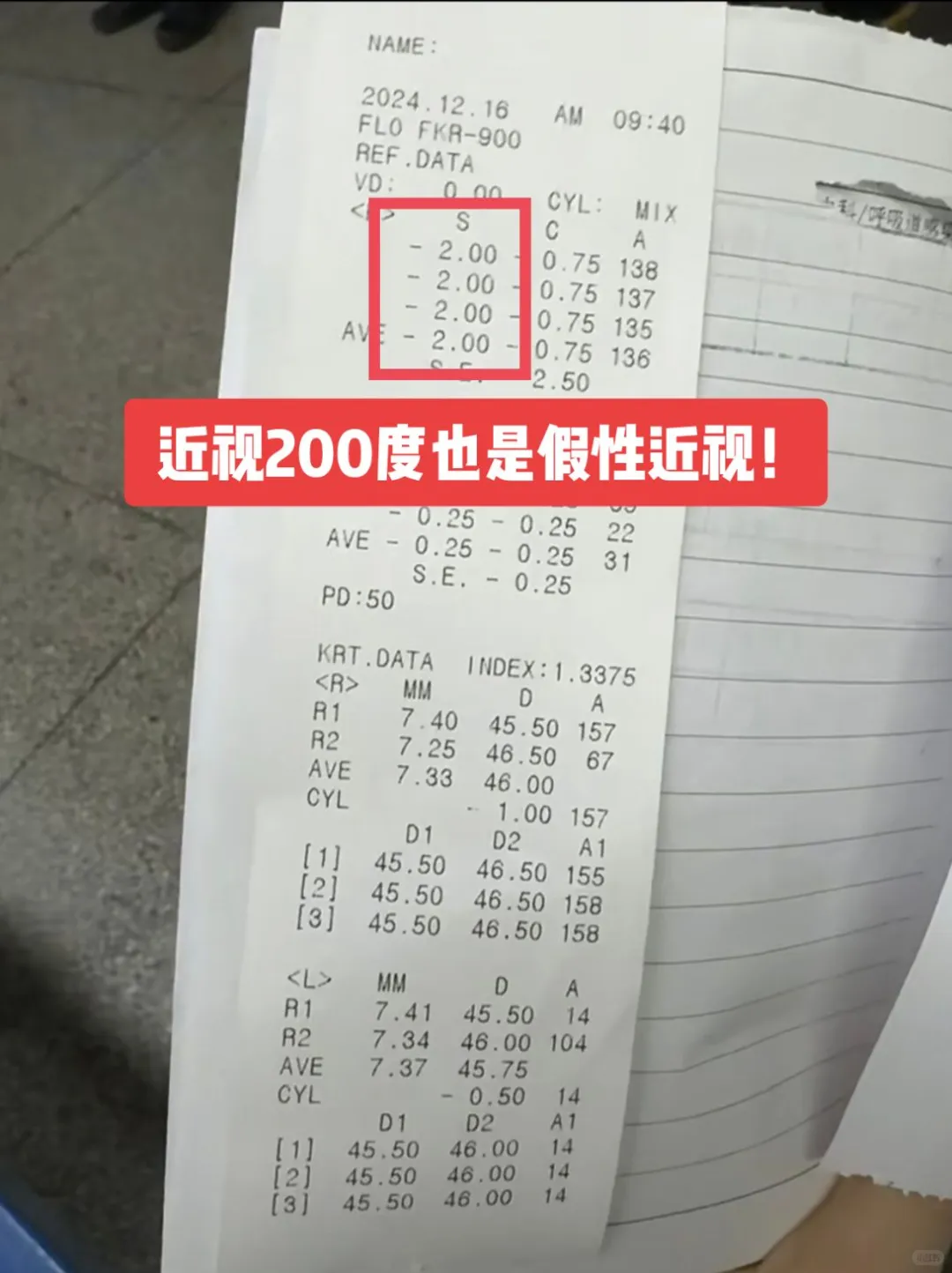 电脑验光误差大，仅作参考莫盲信：