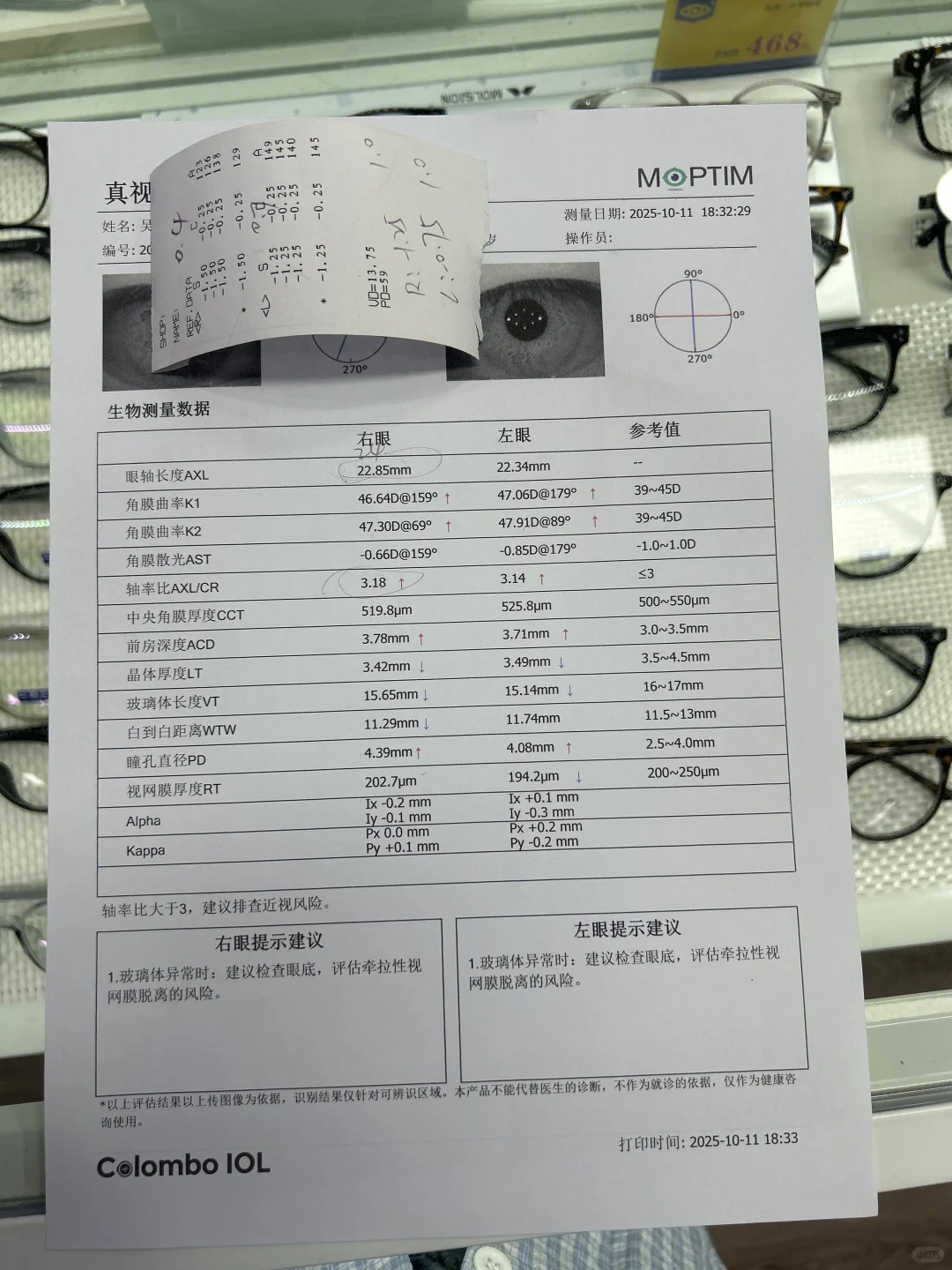 急！！成年人近视有可能降吗？