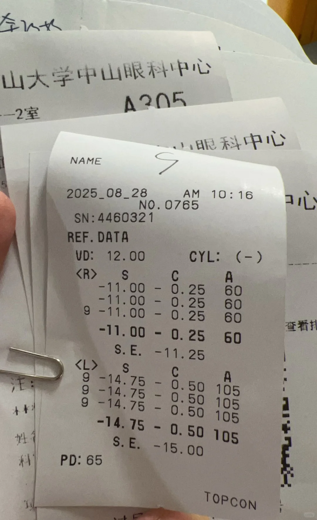 1500度高度近视