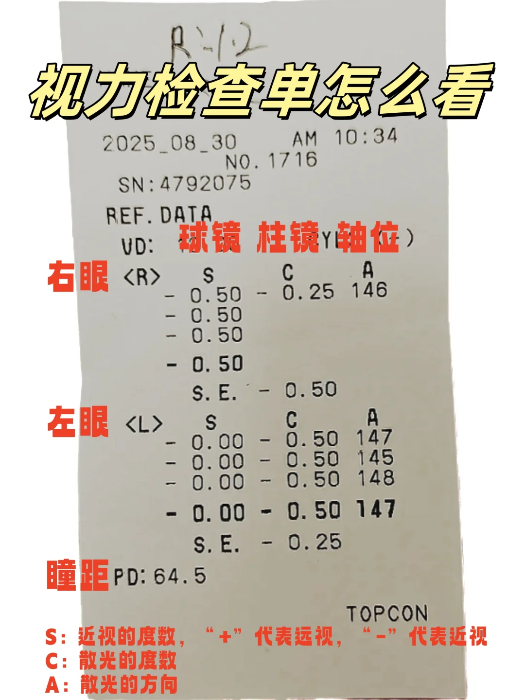 1分钟教会你,孩子视力检查单怎么看