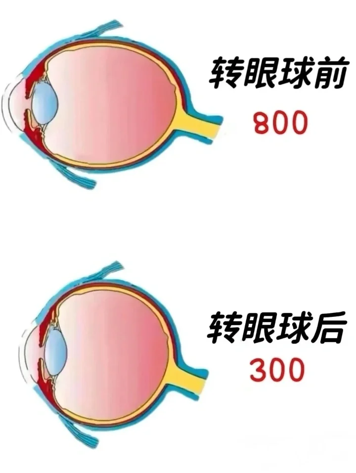 高度进视，一定要尝试这样转眼球！