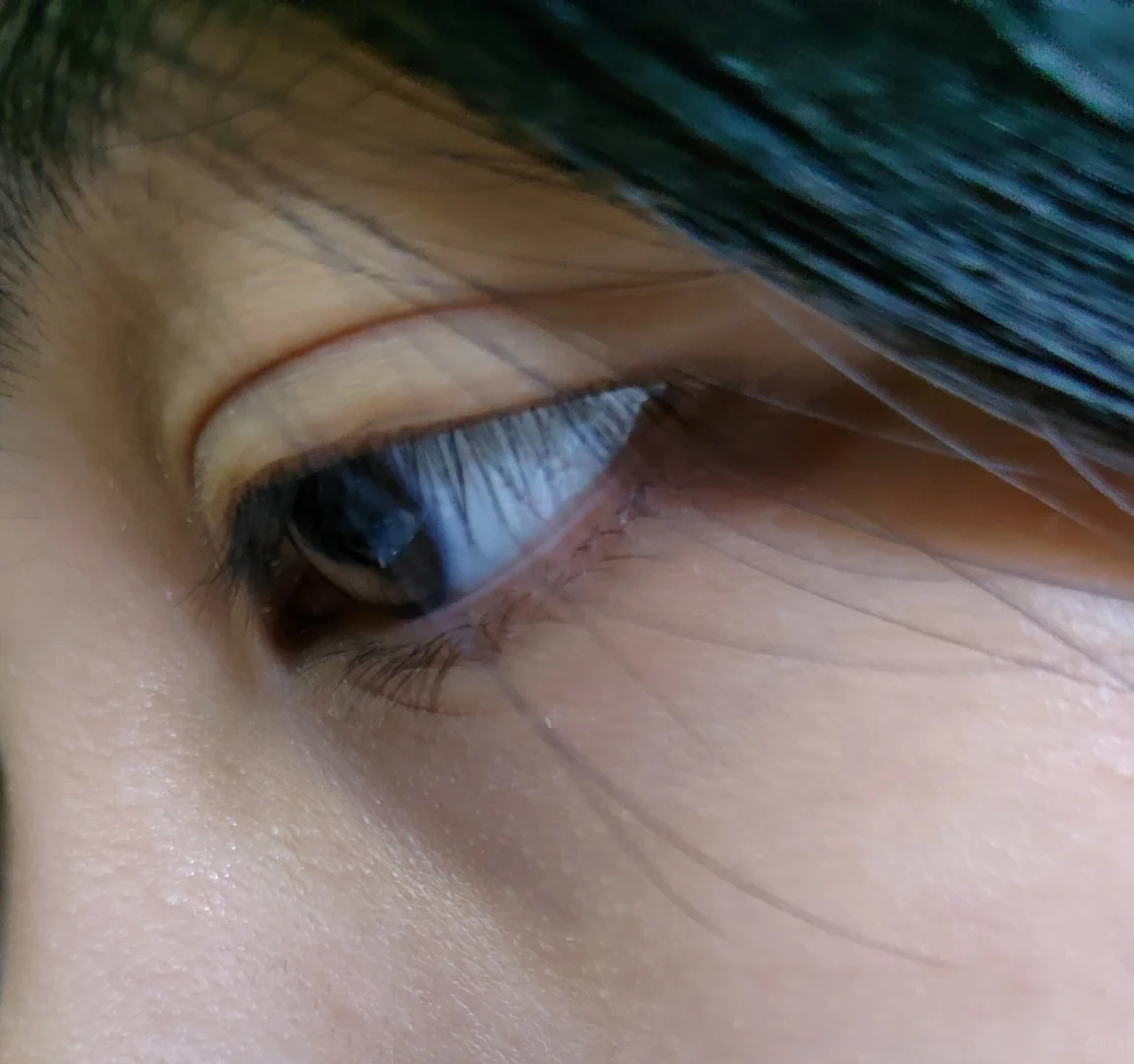 近视800度的眼睛长啥样