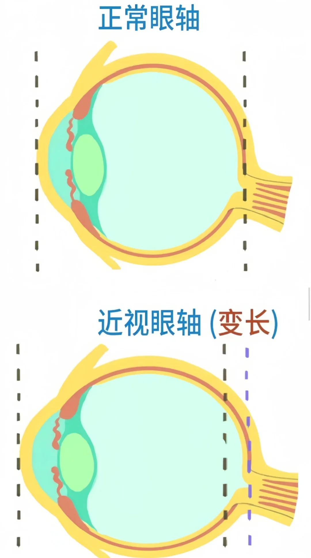这两对比差别竟然在这儿？