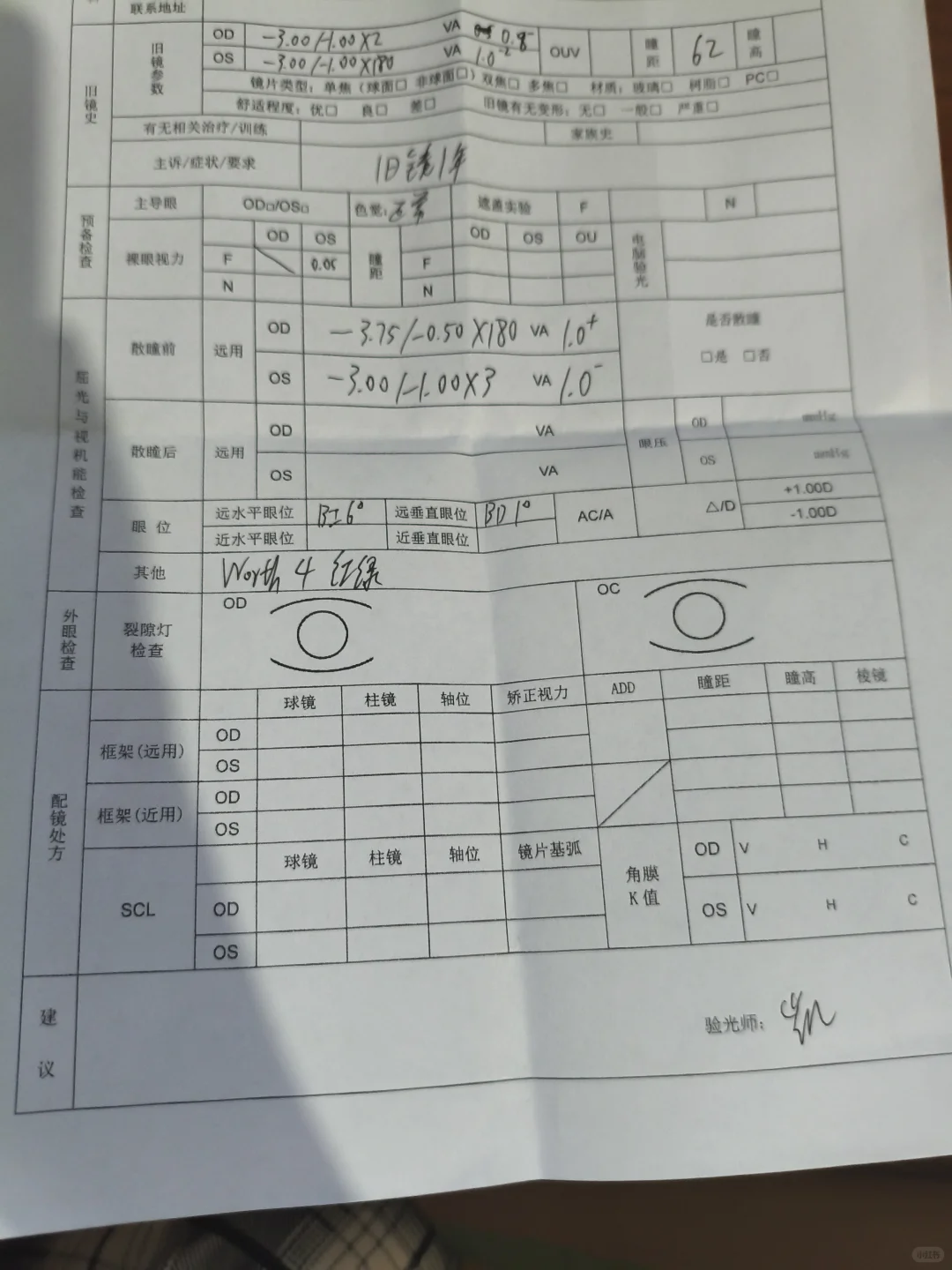 眼镜店与眼科医院验光的真实案例（供参考）