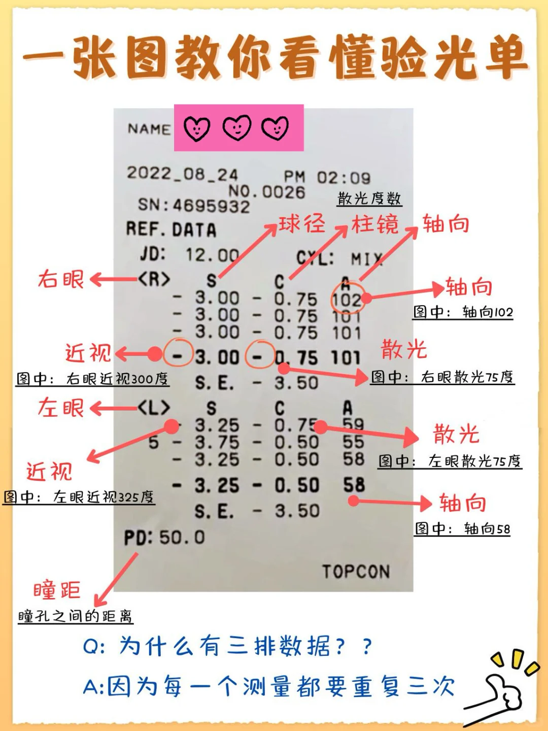 什么？你还不会看验光单！赶紧学起来，超简单
