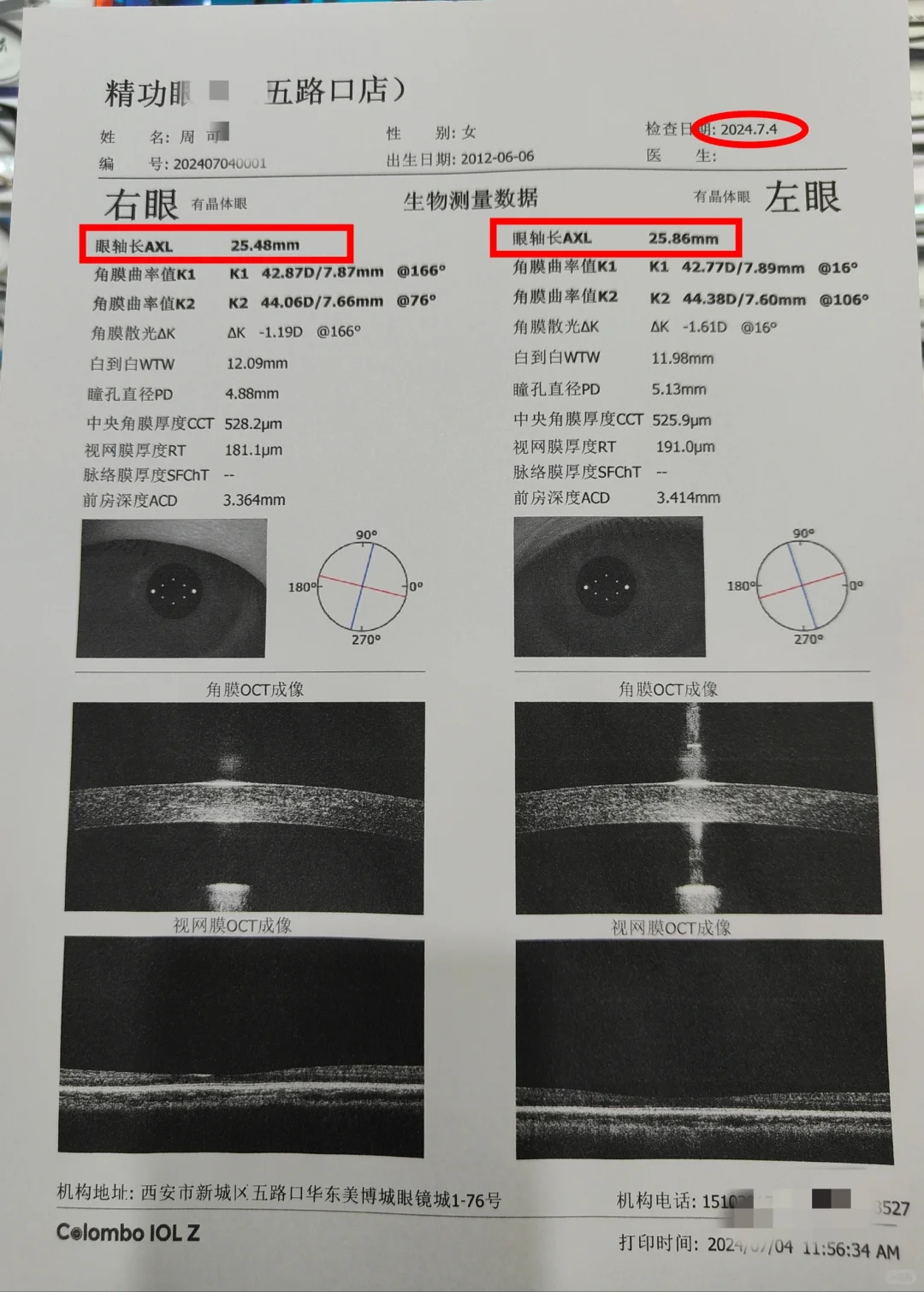 你会给孩子测量眼轴吗,西安来这家就对了