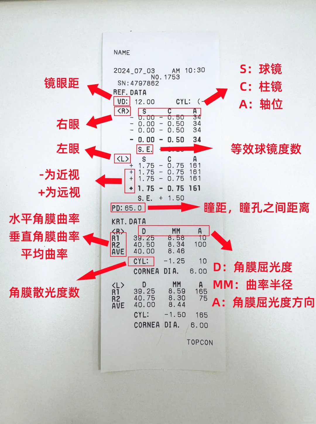 验光单解读
