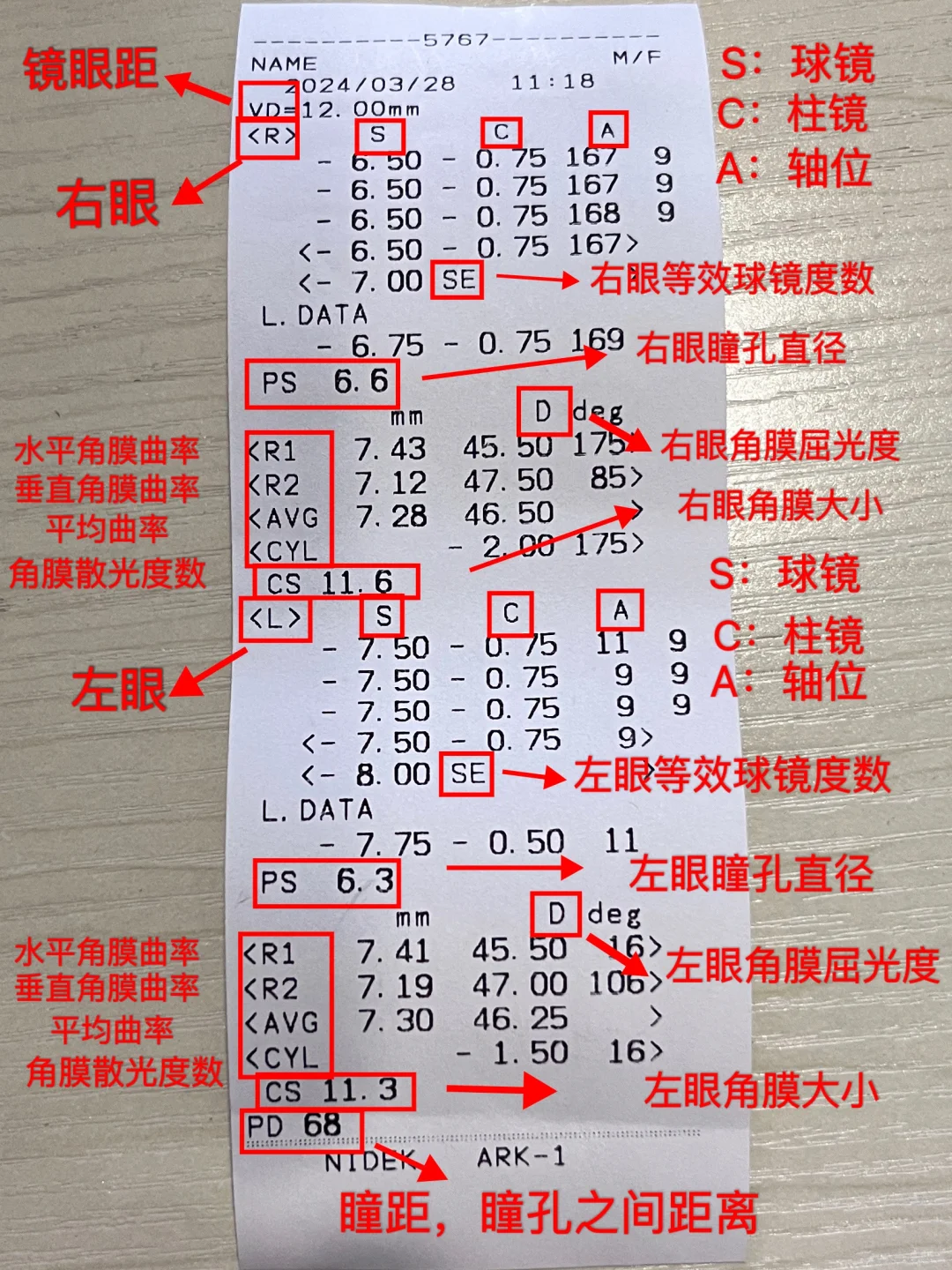 如何通过验光单看懂你的眼睛度数