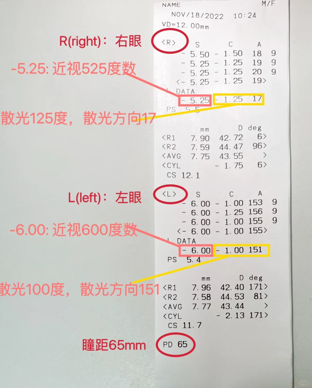 还在问你的医生朋友怎么看验光单吗?