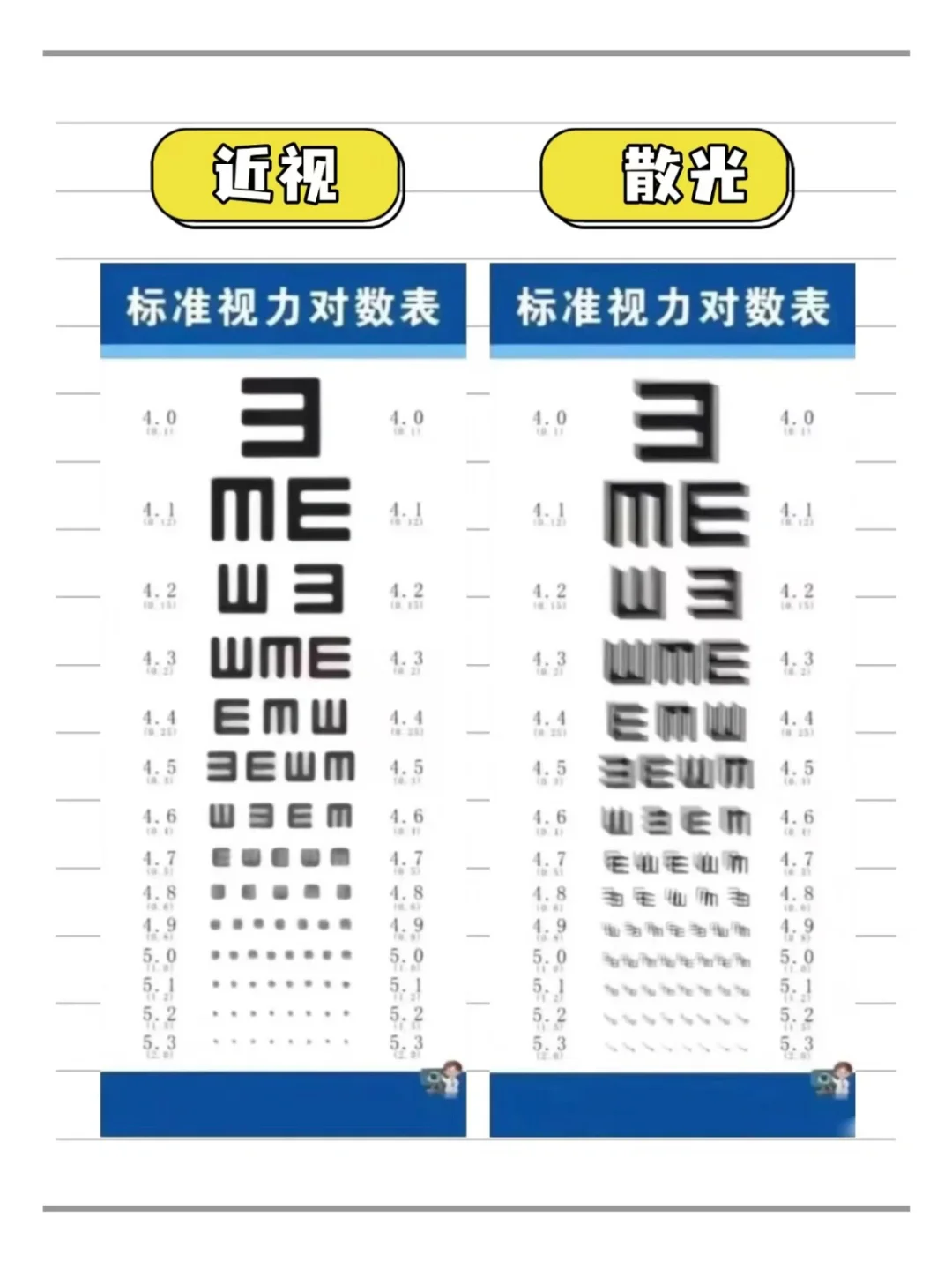 必懂!近视散光远视大白话科普