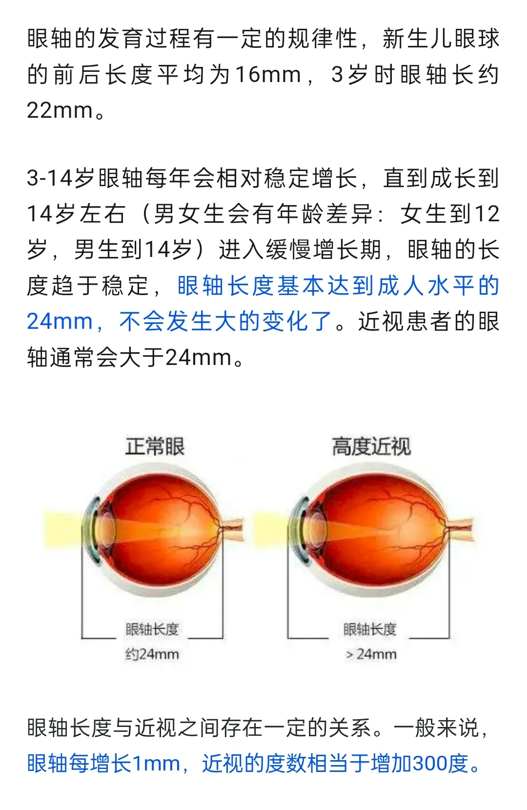 终于看懂眼轴和曲率的检查报告了
