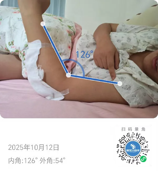 肘关节康复十一天，这个度数有变化吗