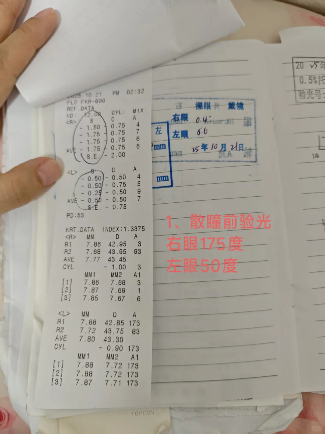 散瞳后验光比散瞳前度数还大？怎么配镜