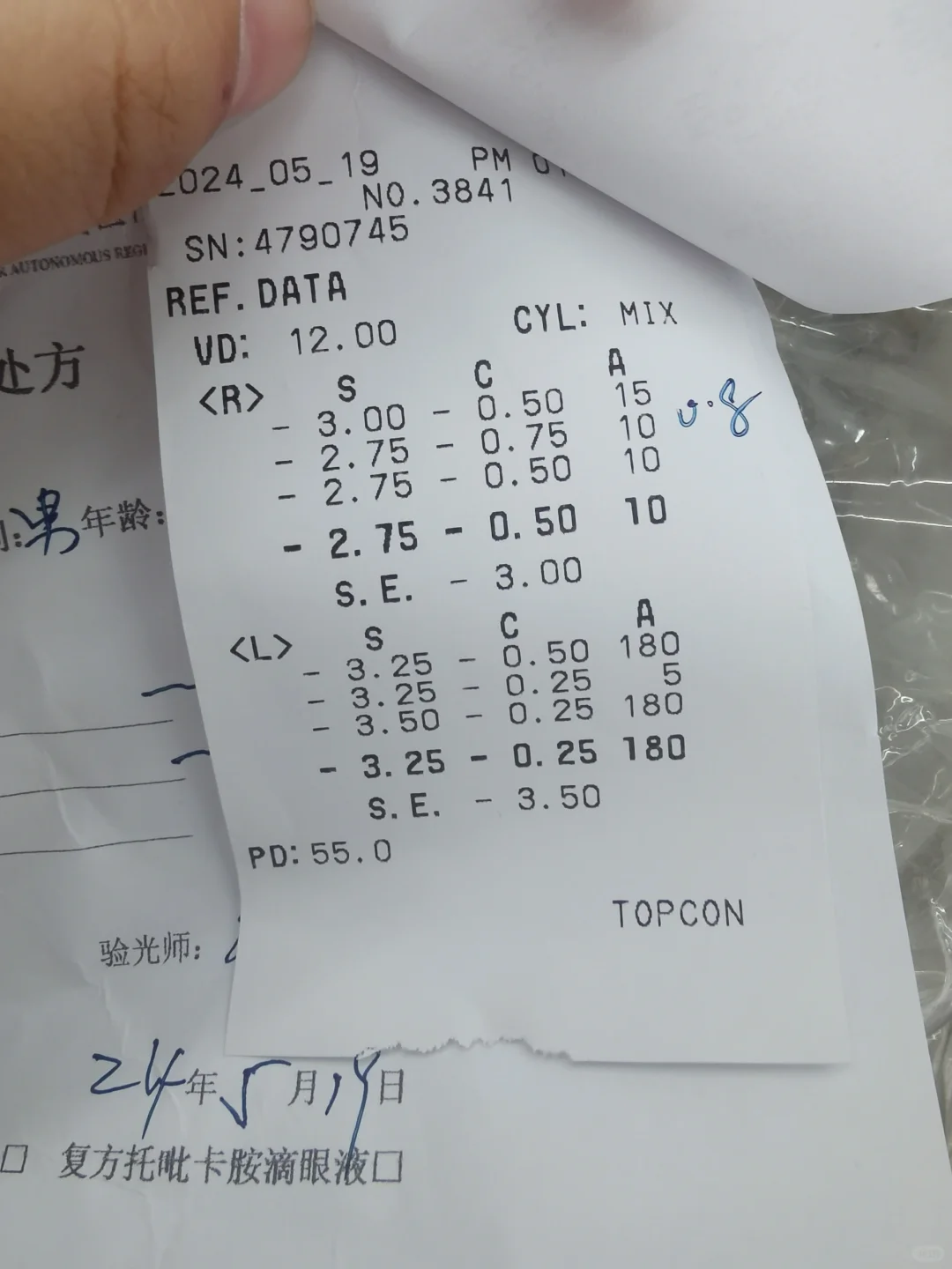 不到10岁近视300度，好焦虑呀，