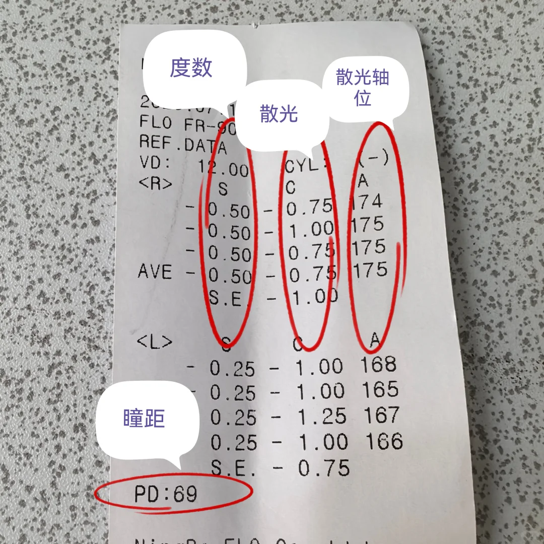 怎么去线下获精准验光?