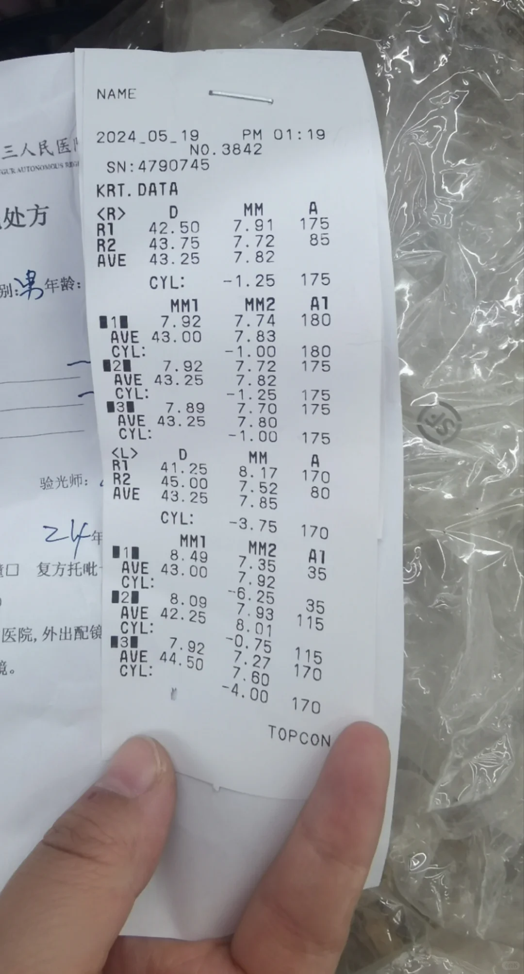 不到10岁近视300度，好焦虑呀，