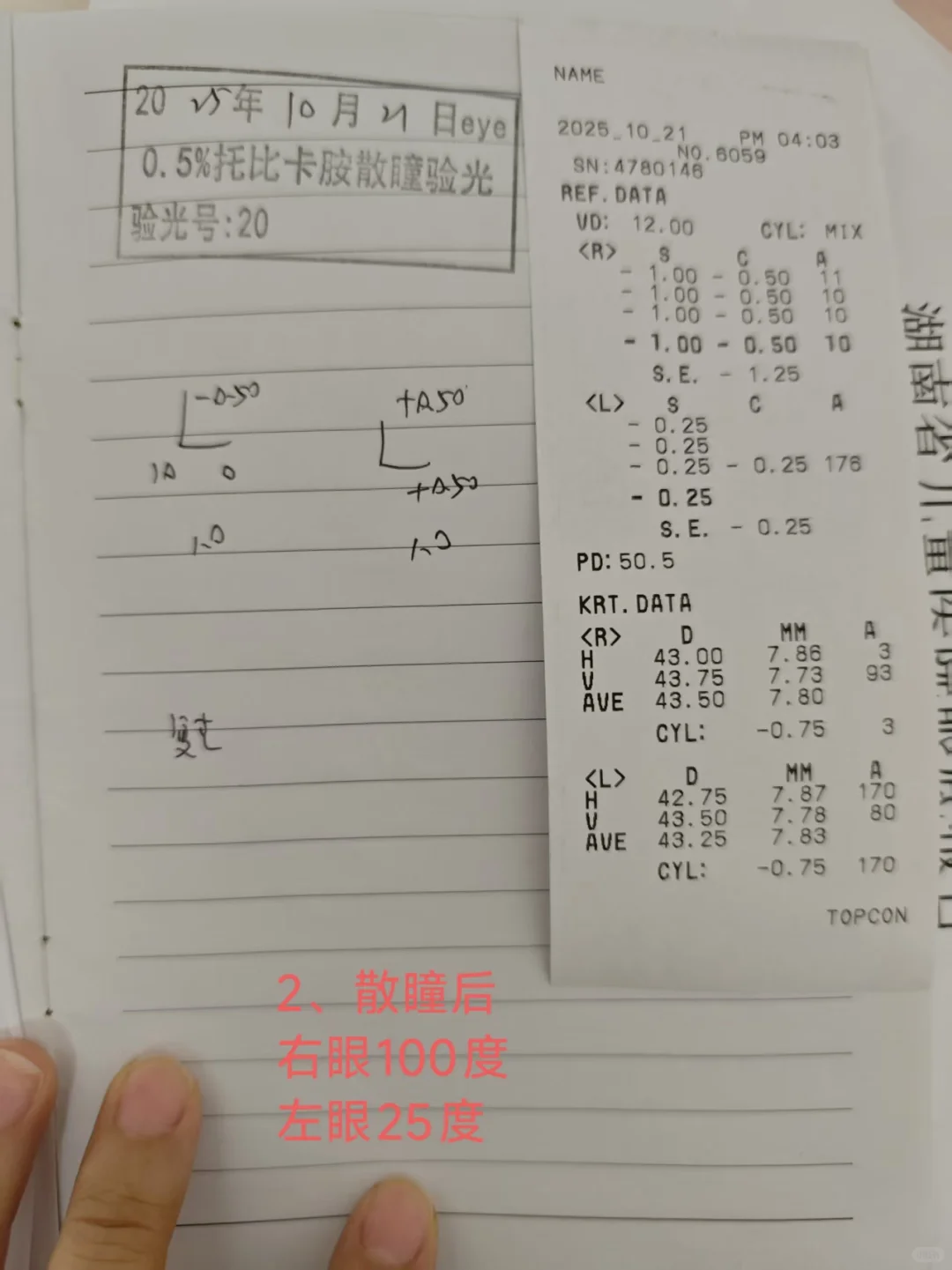 散瞳后验光比散瞳前度数还大？怎么配镜