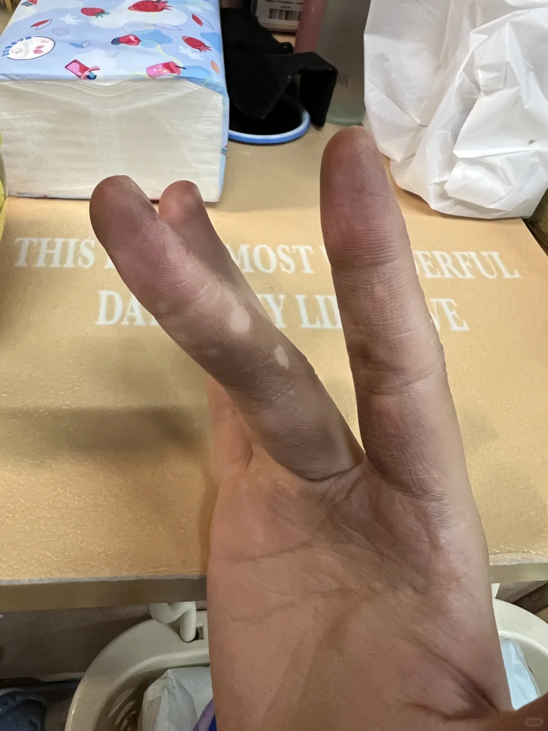 求去核桃汁液的好办法?