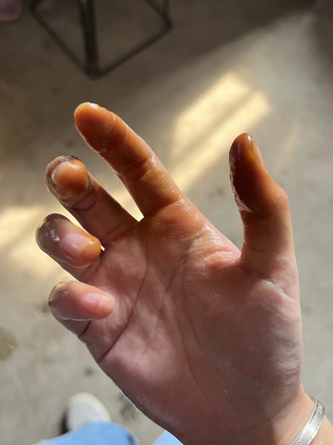 求去核桃汁液的好办法?