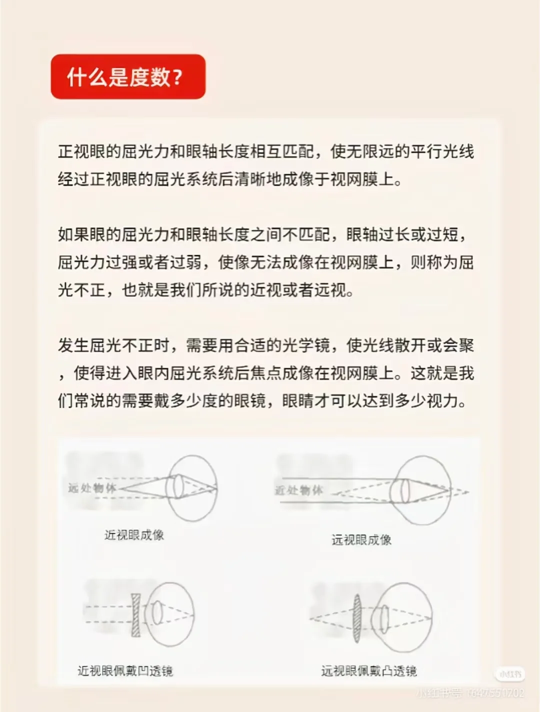 裸视力和近视度数的区别