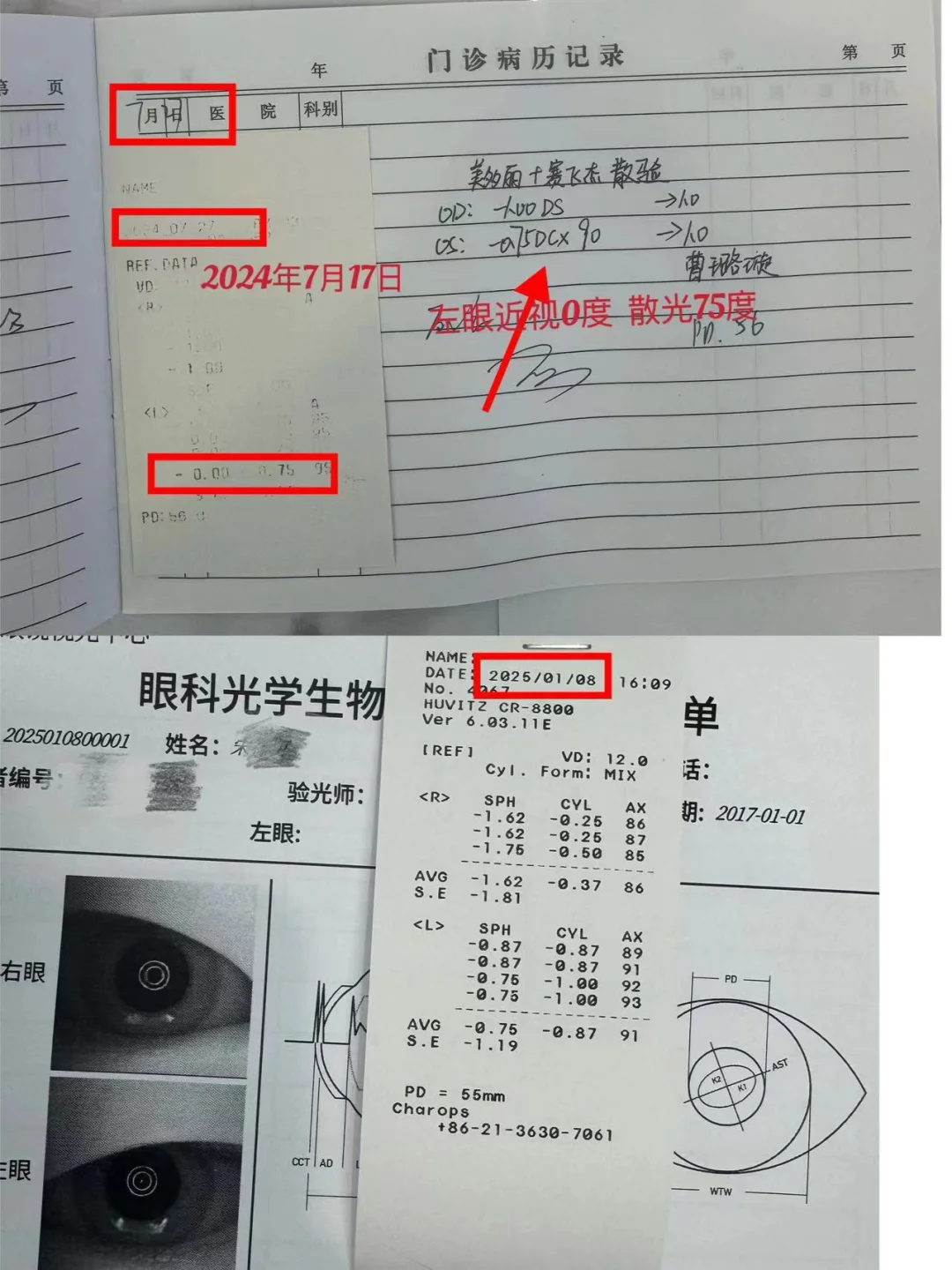 很多家长想象不到近视度数增长的速度这么快