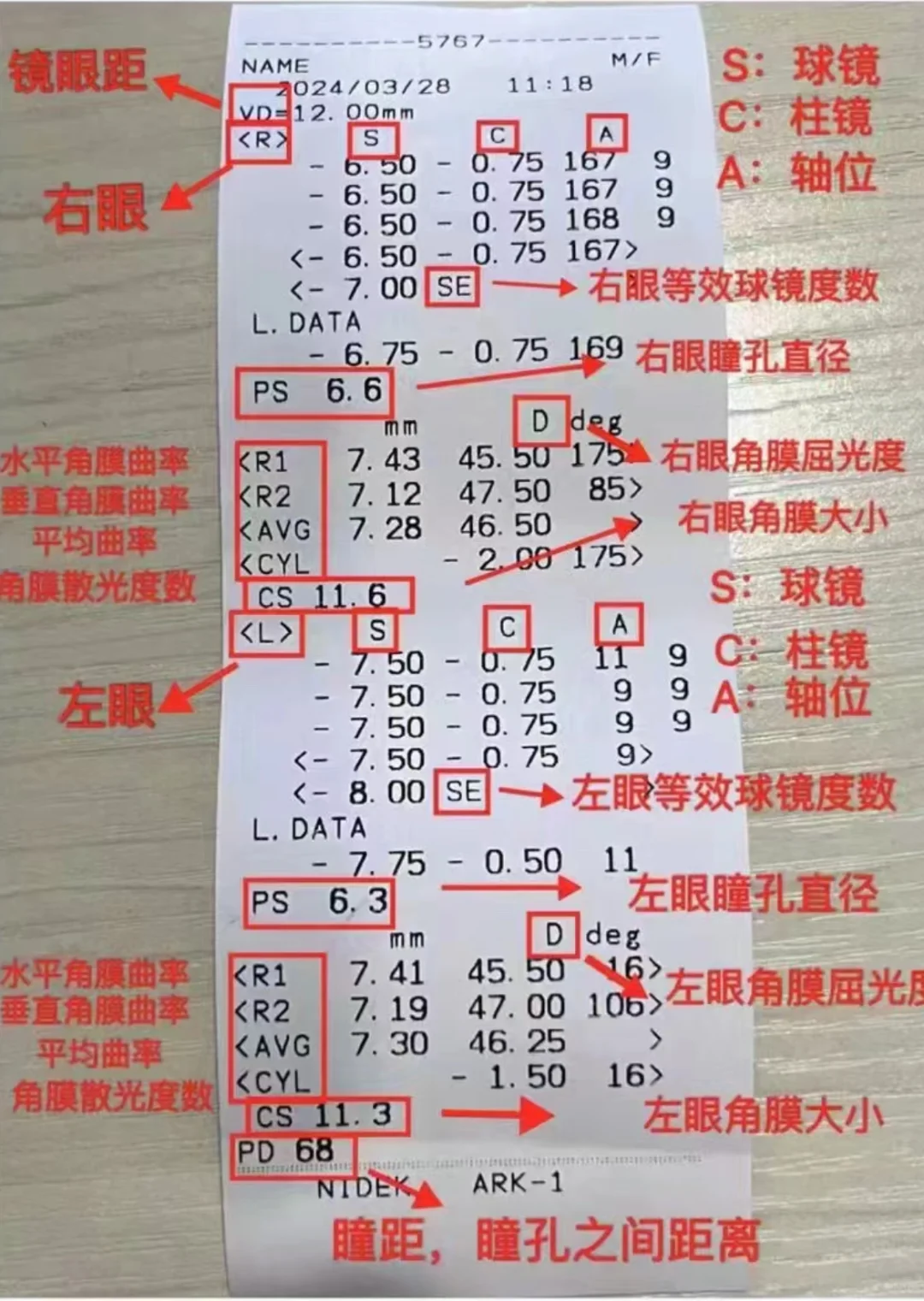 通过验光单怎么看懂眼睛的度数?