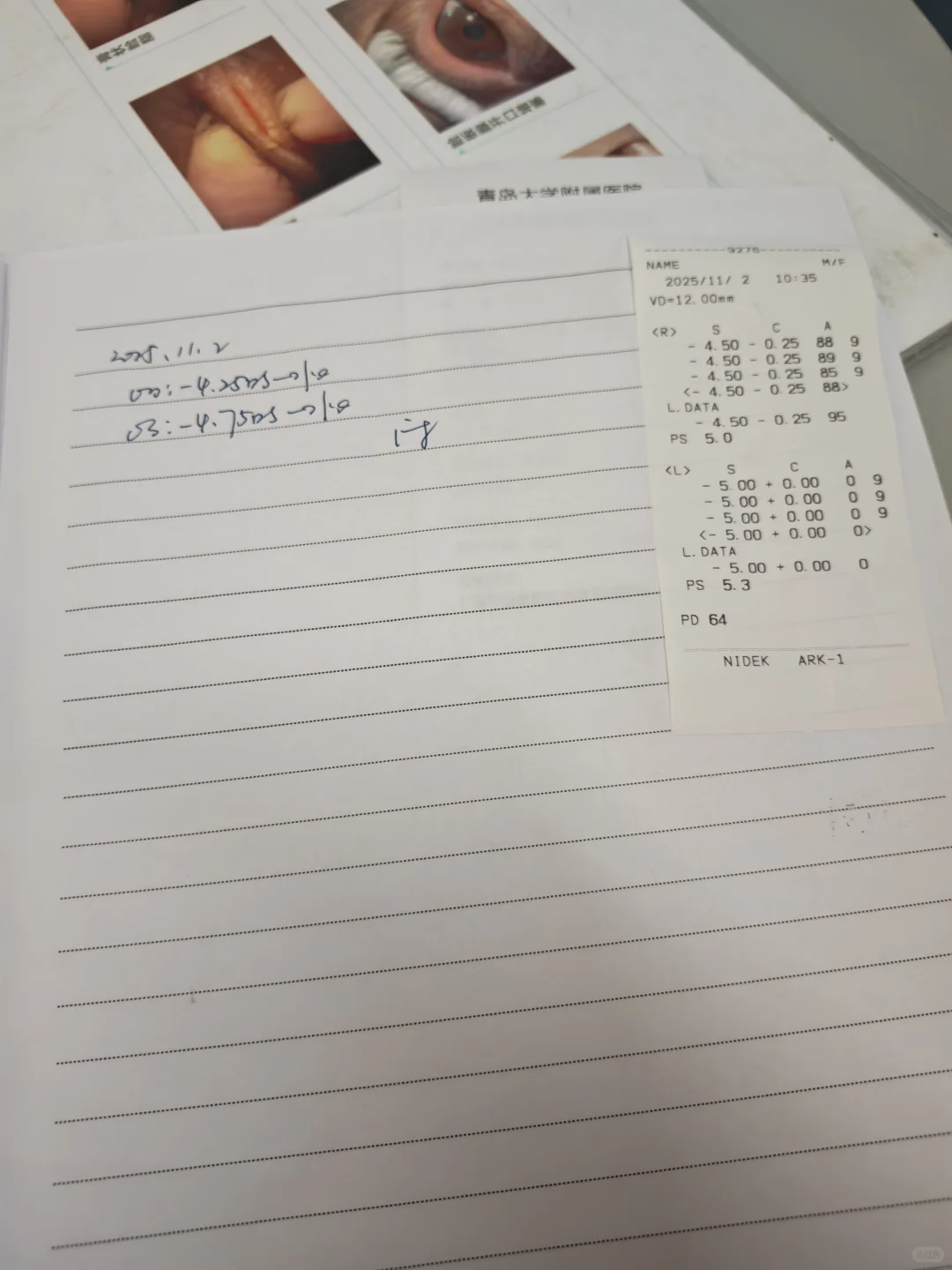 哪个是左眼度数 哪个是右眼度数